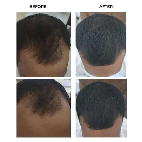 Before After Result