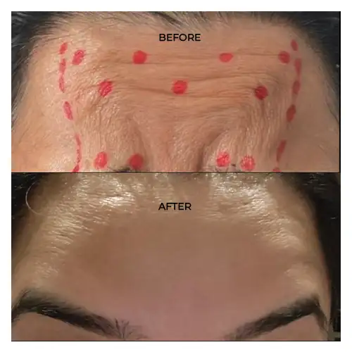 Before After Result
